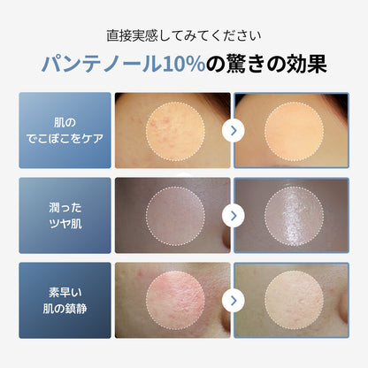 【12/23発送】【セット】保湿-肌バリア機能特化（パンテノールローション + パンテノールクリーム）