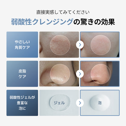 ソフト モイスチャー ジェル クレンザー 150ml / クレンジング 洗顔 敏感肌 弱酸性 毛穴 皮脂 角質 さっぱり しっとり スキンケア 鎮静 無着色