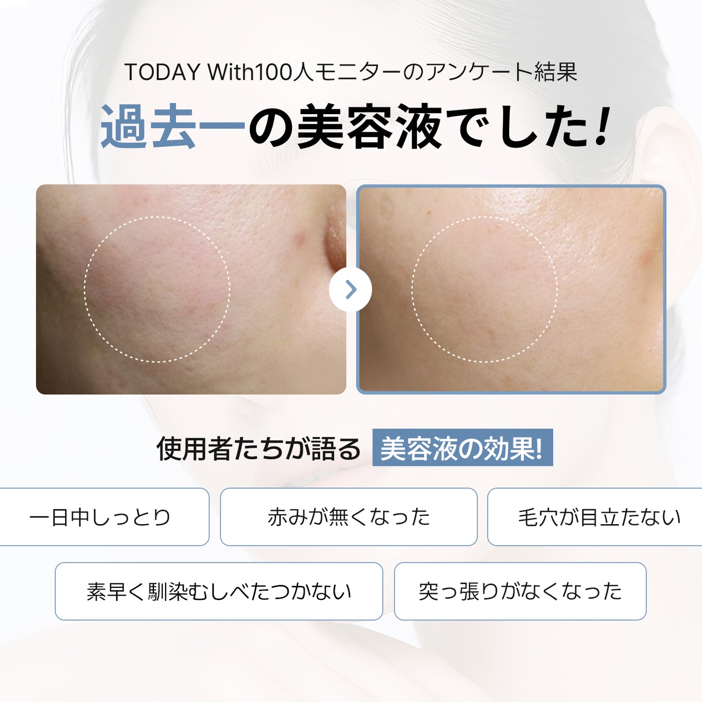 【12/23発送】【セット】鎮静-保湿バリア強化（鎮静美容液+パンテノールクリーム）