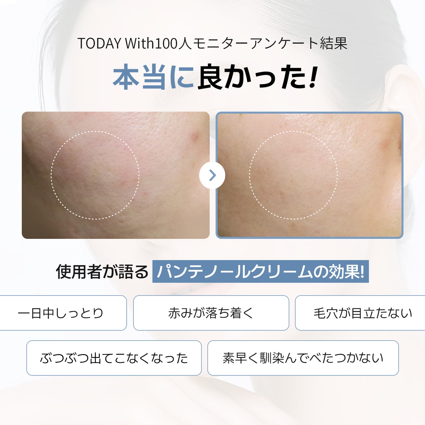 【12/23発送】【セット】鎮静-保湿バリア強化（鎮静美容液+パンテノールクリーム）