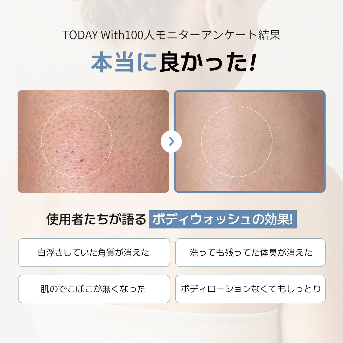 【公式ストア限定割引】ソフト モイスチャー酵素ボディウォッシュ 500ml / ボディソープ 酵素 弱酸性 角質 ニオイ 体臭 しっとり 保湿 ヒアルロン酸 敏感肌 無香料