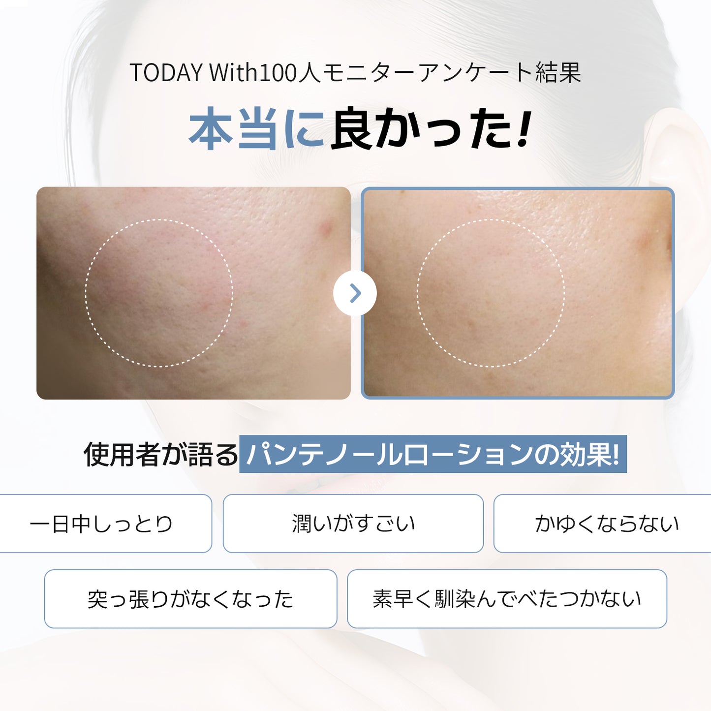 ソフト モイスチャー パンテノール ローション 300ml / 敏感肌 パンテノール5％ 保湿 しっとり 鎮静 無香料 無着色 スキンケア 潤い