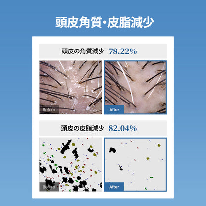 【６月メガセール】全身ケアセット 酵素ボディウォッシュ＋塩＆酵素スカルプシャンプー