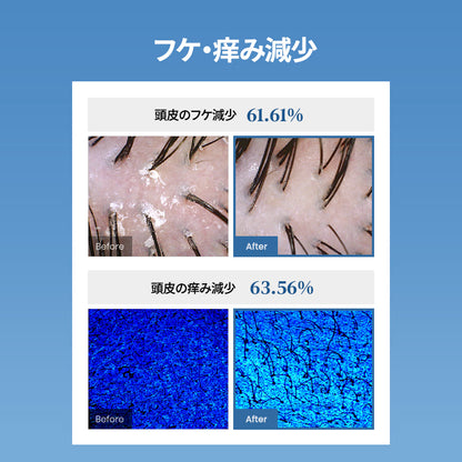 【６月メガセール】全身ケアセット 酵素ボディウォッシュ＋塩＆酵素スカルプシャンプー